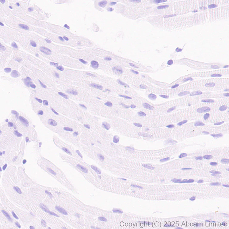 Immunohistochemistry (Formalin/PFA-fixed paraffin-embedded sections) - Anti-SMP30 antibody [EPR29674-517] (AB324949)
