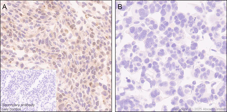Immunohistochemistry (Formalin/PFA-fixed paraffin-embedded sections) - Anti-SMP30 antibody [EPR29674-517] (AB324949)