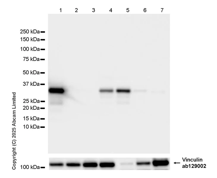 Western blot - Anti-SMP30 antibody [EPR29674-517] (AB324949)