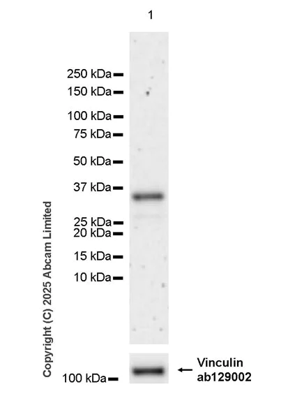 Western blot - Anti-SMP30 antibody [EPR29674-517] (AB324949)