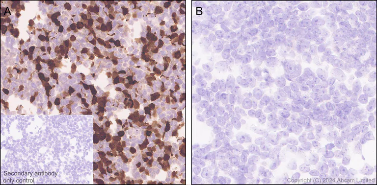 Immunohistochemistry (Formalin/PFA-fixed paraffin-embedded sections) - Anti-Smt3 antibody [EPR28614-578] (AB322402)