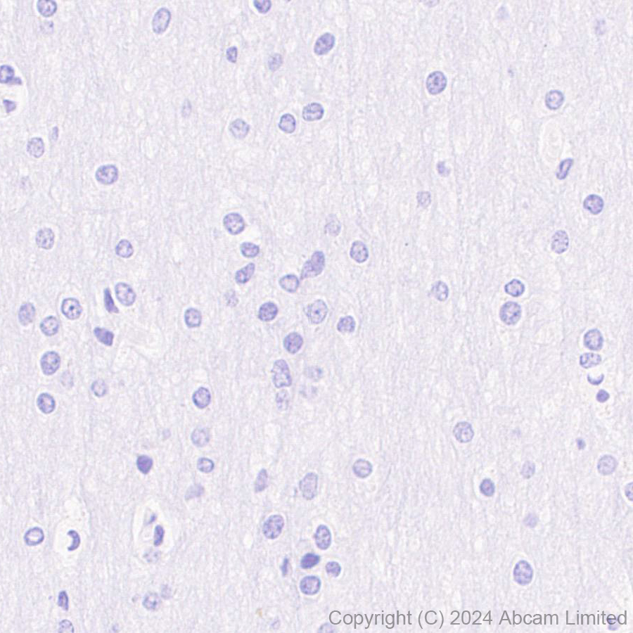 Immunohistochemistry (Formalin/PFA-fixed paraffin-embedded sections) - Anti-Smt3 antibody [EPR28614-578] (AB322402), expandable thumbnail