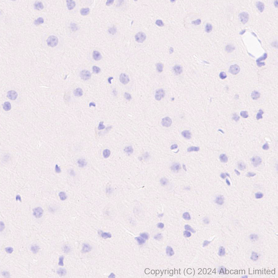 Immunohistochemistry (Formalin/PFA-fixed paraffin-embedded sections) - Anti-Smt3 antibody [EPR28614-578] (AB322402), expandable thumbnail