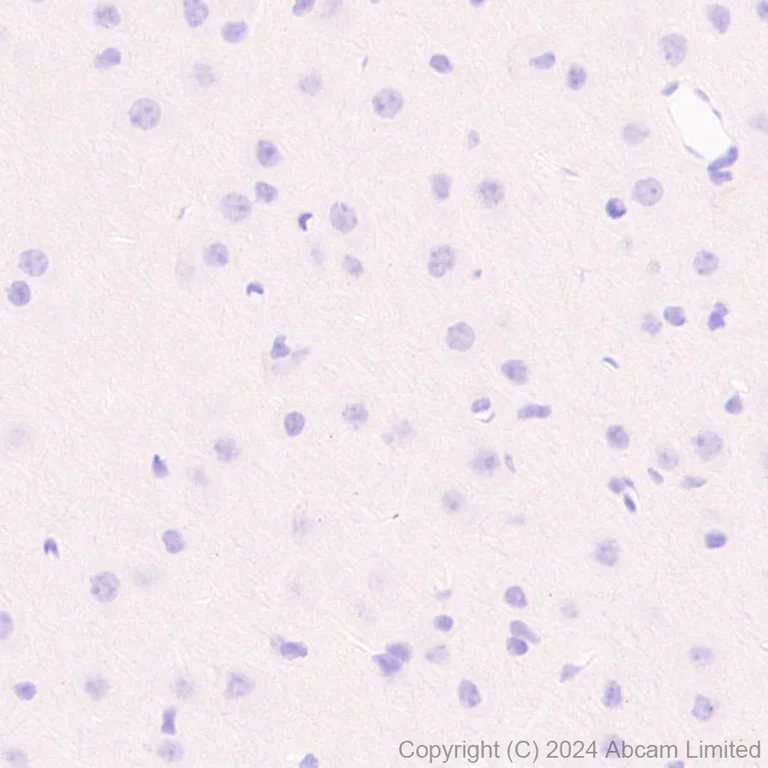 Immunohistochemistry (Formalin/PFA-fixed paraffin-embedded sections) - Anti-Smt3 antibody [EPR28614-578] (AB322402)