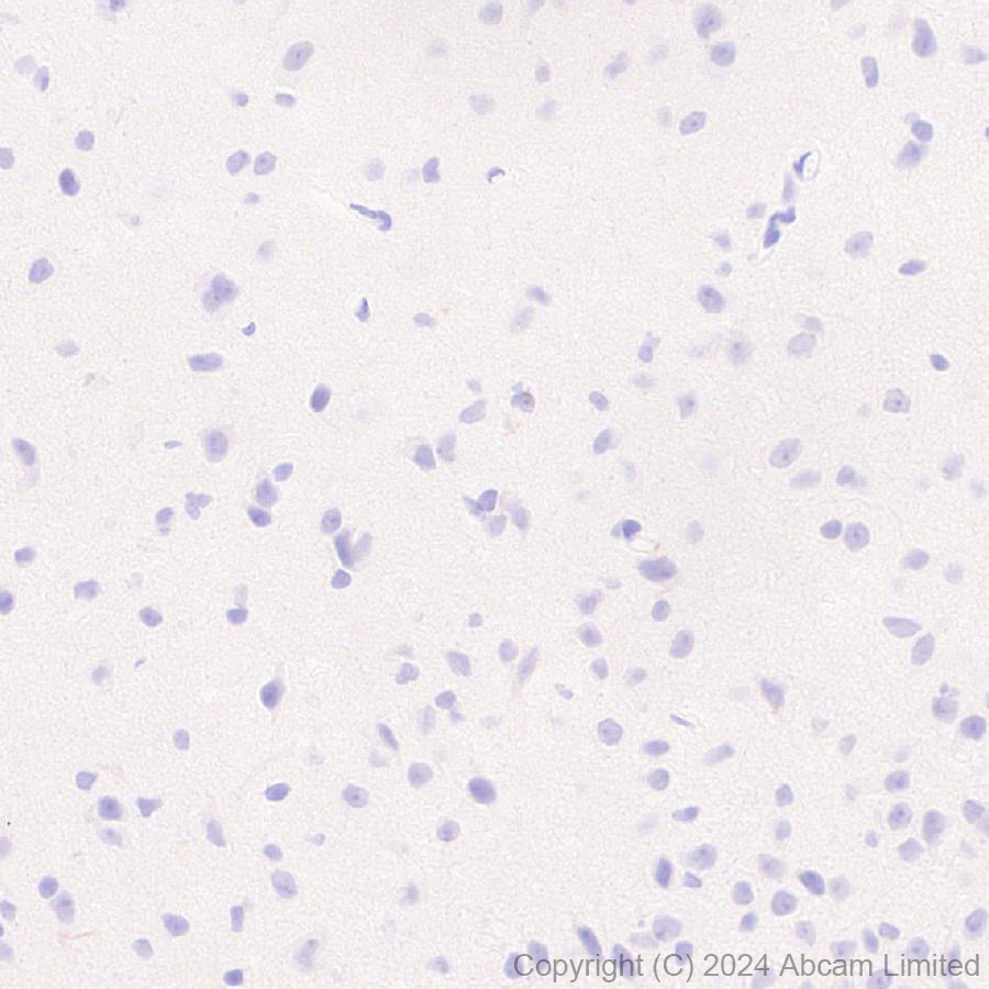 Immunohistochemistry (Formalin/PFA-fixed paraffin-embedded sections) - Anti-Smt3 antibody [EPR28614-578] (AB322402), expandable thumbnail