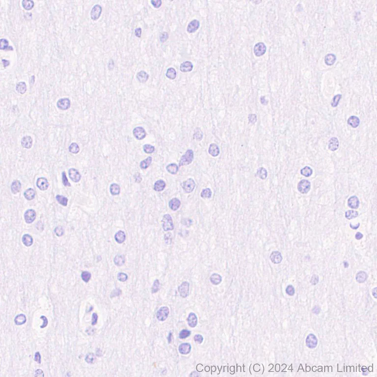 Immunohistochemistry (Formalin/PFA-fixed paraffin-embedded sections) - Anti-Smt3 antibody [EPR28614-578] - BSA and Azide free (AB324844)