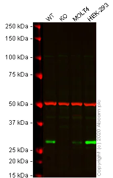 Western blot - Anti-SMUG1 antibody [EPR15624] (AB192240)