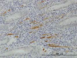 Immunohistochemistry (Formalin/PFA-fixed paraffin-embedded sections) - Anti-SMURF1 antibody [1D7] (AB57573)