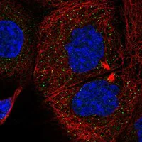 Immunocytochemistry/ Immunofluorescence - Anti-SMURF1 Antibody (AB327198)