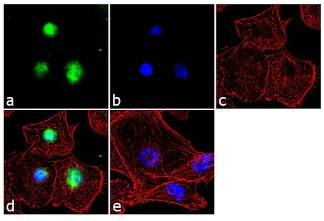 Immunocytochemistry/ Immunofluorescence - Anti-SMURF2 Antibody [RP23040176] (AB313470)