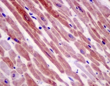 Immunohistochemistry (Formalin/PFA-fixed paraffin-embedded sections) - Anti-SMYD1 antibody [EPR13574(B)-30] (AB181372)