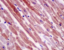 Immunohistochemistry (Formalin/PFA-fixed paraffin-embedded sections) - Anti-SMYD1 antibody [EPR13574(B)-30] - BSA and Azide free (AB250496)