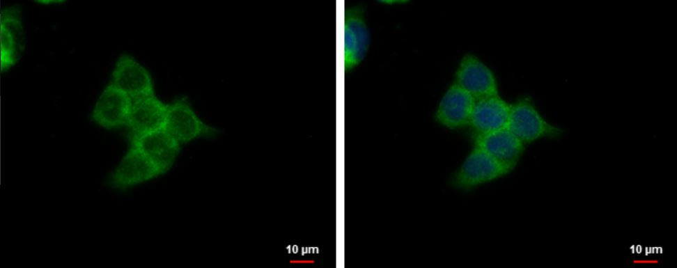 Immunocytochemistry/ Immunofluorescence - Anti-SMYD3 antibody (AB155018), expandable thumbnail