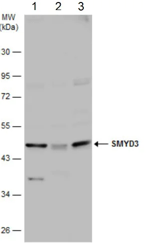 Western blot - Anti-SMYD3 antibody (AB155018)