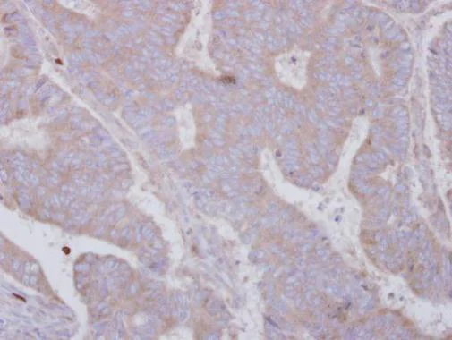 Immunohistochemistry (Formalin/PFA-fixed paraffin-embedded sections) - Anti-SMYD3 antibody (AB228015)