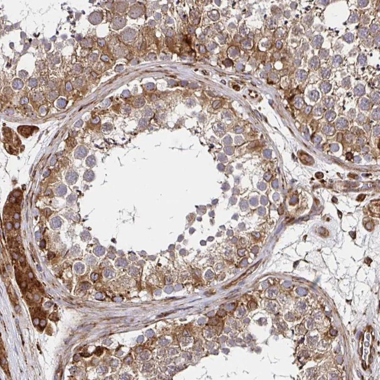 Immunohistochemistry (Formalin/PFA-fixed paraffin-embedded sections) - Anti-SMYD3 Antibody (AB327239)