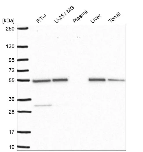 Western blot - Anti-SMYD3 Antibody (AB327239)
