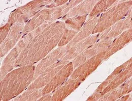 Immunohistochemistry (Formalin/PFA-fixed paraffin-embedded sections) - Anti-SMYD3 antibody [EPR11106(2)] - BSA and Azide free (AB250657)