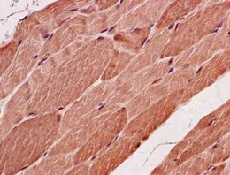 Immunohistochemistry (Formalin/PFA-fixed paraffin-embedded sections) - Anti-SMYD3 antibody [EPR11106(2)] - N-terminal (AB183498)