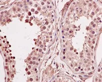 Immunohistochemistry (Formalin/PFA-fixed paraffin-embedded sections) - Anti-SMYD3 antibody [EPR11106(2)] - N-terminal (AB183498)
