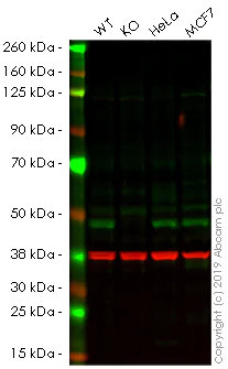 Western blot - Anti-SMYD3 antibody [EPR11106(2)] - N-terminal (AB183498)