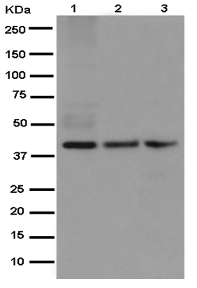 Western blot - Anti-SMYD3 antibody [EPR11107(2)] (ab187149), expandable thumbnail