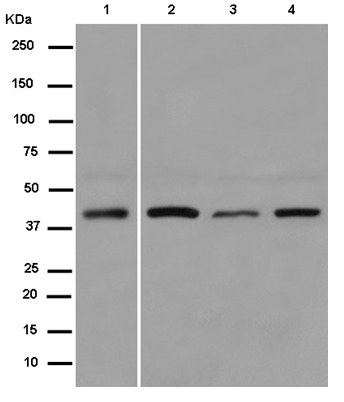 Western blot - Anti-SMYD3 antibody [EPR11107(2)] (AB187149), expandable thumbnail