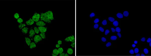 Immunocytochemistry/ Immunofluorescence - Anti-SMYD3 antibody [EPR11107(2)] - BSA and Azide free (AB232626)