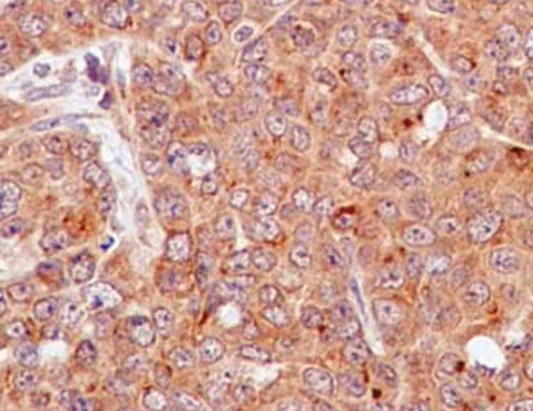 Immunohistochemistry (Formalin/PFA-fixed paraffin-embedded sections) - Anti-SMYD3 antibody [EPR11107(2)] - BSA and Azide free (AB232626)