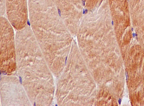 Immunohistochemistry (Formalin/PFA-fixed paraffin-embedded sections) - Anti-SMYD3 antibody [EPR11107(2)] - BSA and Azide free (ab232626), expandable thumbnail