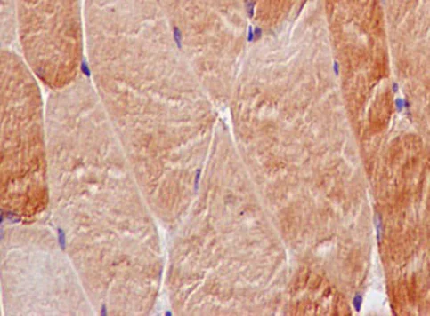 Immunohistochemistry (Formalin/PFA-fixed paraffin-embedded sections) - Anti-SMYD3 antibody [EPR11107(2)] - BSA and Azide free (AB232626)