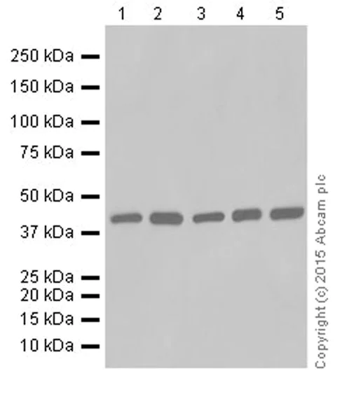 Western blot - Anti-SMYD3 antibody [EPR19311] (AB199361)