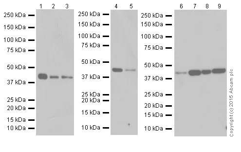 Western blot - Anti-SMYD3 antibody [EPR19311] (AB199361)