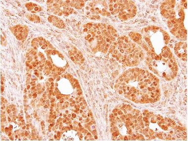 Immunohistochemistry (Formalin/PFA-fixed paraffin-embedded sections) - Anti-SMYD5 antibody - C-terminal (AB137622)