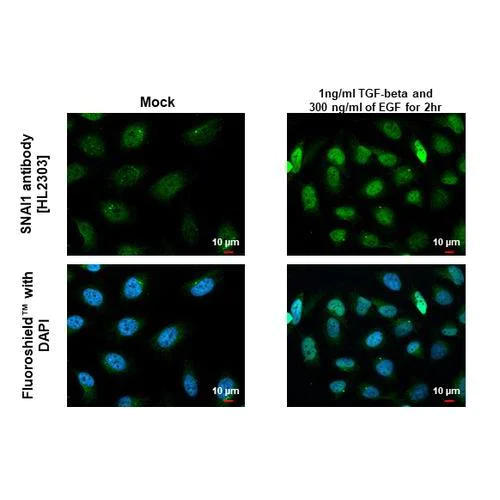 Immunocytochemistry/ Immunofluorescence - Anti-SNAI1 antibody [HL2303] (AB317193)