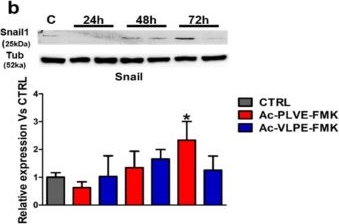 Western blot - Anti-SNAIL antibody [EPR21043] (ab216347), expandable thumbnail