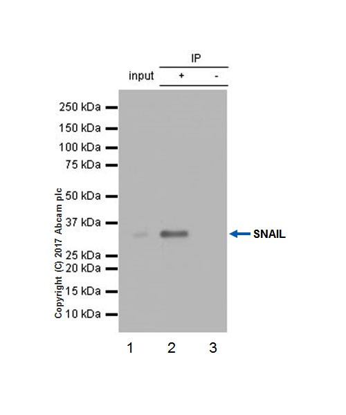 Immunoprecipitation - Anti-SNAIL antibody [EPR21043] - BSA and Azide free (AB229701), expandable thumbnail