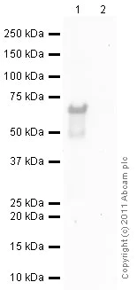 Western blot - Anti-SNAIL antibody [Sn9H2] (AB31787)
