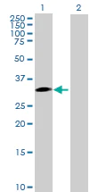 Western blot - Anti-SNAIL + SLUG antibody (AB167609)