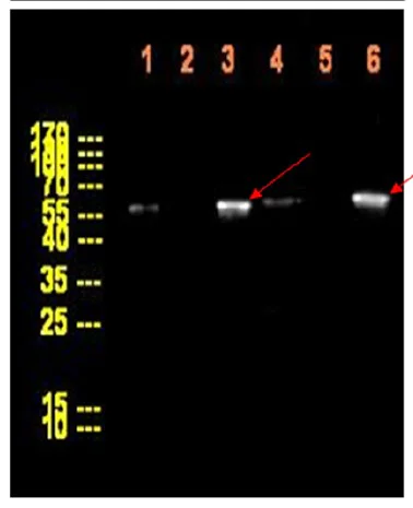 Western blot - Anti-SNAIL + SLUG antibody (AB167609)