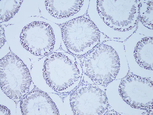 Immunohistochemistry (Formalin/PFA-fixed paraffin-embedded sections) - Anti-SNAIL + SLUG antibody (AB180714)
