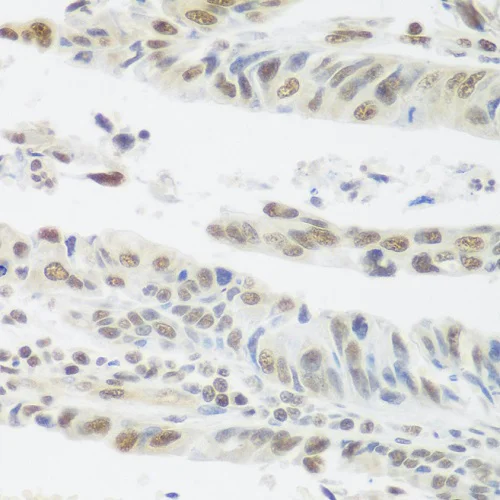 Immunohistochemistry (Formalin/PFA-fixed paraffin-embedded sections) - Anti-SNAIL + SLUG antibody (AB180714)