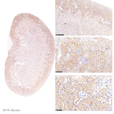Immunohistochemistry (Formalin/PFA-fixed paraffin-embedded sections) - Anti-SNAIL + SLUG antibody (AB180714)