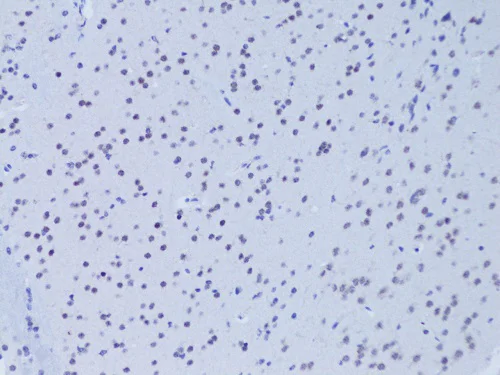 Immunohistochemistry (Formalin/PFA-fixed paraffin-embedded sections) - Anti-SNAIL + SLUG antibody (AB180714)