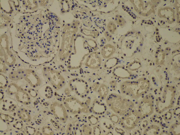 Immunohistochemistry (Formalin/PFA-fixed paraffin-embedded sections) - Anti-SNAIL + SLUG antibody (AB180714)