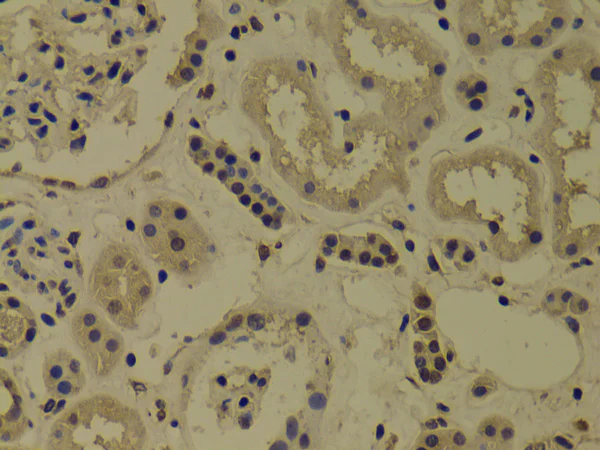 Immunohistochemistry (Formalin/PFA-fixed paraffin-embedded sections) - Anti-SNAIL + SLUG antibody (AB180714)