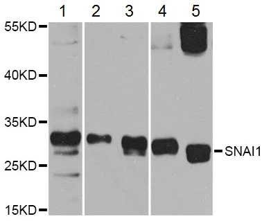 Western blot - Anti-SNAIL + SLUG antibody (AB180714)