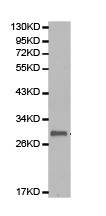 Western blot - Anti-SNAIL + SLUG antibody (AB180714)