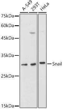 Western blot - Anti-SNAIL + SLUG antibody (AB180714)