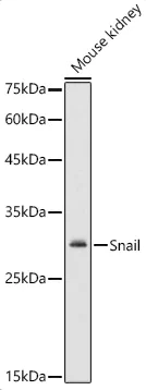 Western blot - Anti-SNAIL + SLUG antibody (AB180714)